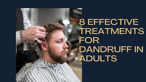 Dandruff in Adults