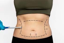 Weight Loss