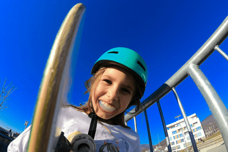 Mouth Guards to Protect Your Smile in Sports